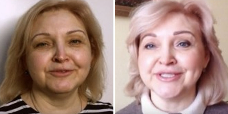Anna, önce ve sonra